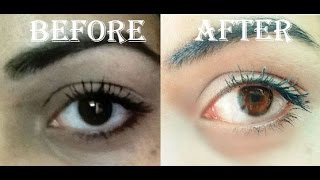 Homemade Eye Brightening Serum  Dark Circle Removing Serum [upl. by Oleusnoc396]