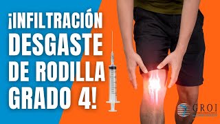 ¡Infiltración para desgaste de rodilla Grado 4 infiltracion artrosisderodilla artrosis salud [upl. by Eitac]