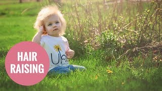 This adorable baby has Uncombable Hair Syndrome [upl. by Nevets]