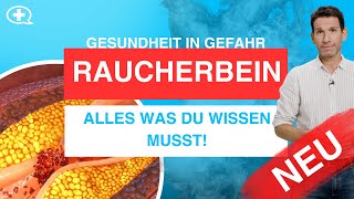 Raucherbein Was ist das Und warum können auch Nichtraucher erkranken [upl. by Nednyl]