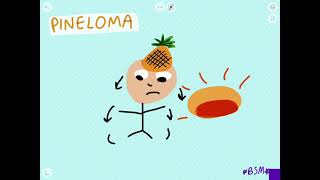 Pinealoma visual Mnemonic  HIGH YIELD  PLABUSMLEMCCQEMSRA [upl. by Sartin]