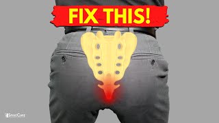 How to Fix Tailbone Pain for Good [upl. by Ahseinod768]