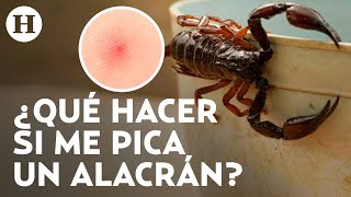 ¡Temporada de alacranes en México Esto debes hacer en caso de ser picado por uno de estos animales [upl. by Molloy]