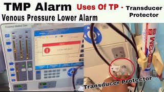 VenousTMP Alarm during Hemodialysis Use of TPTransducer Protector  Prevention of dialysis Access [upl. by Yht425]