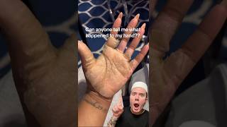 CRAZY HAND PEELING😱 follow for more💗 skincareroutine skincaretips skin beautytips [upl. by Reviere]