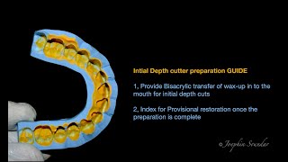 Veneer preparation GUIDE Initial Depth cutter [upl. by Lirret]