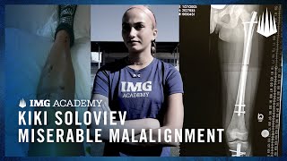 Kiki Soloviev  Miserable Malalignment [upl. by Abdul]