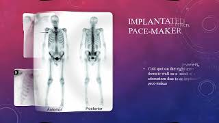 Artifacts in bone scintigraphy MCQs nuclearmedicineMCQ nuclearmedicine RSO frcr bonescan [upl. by Nats]