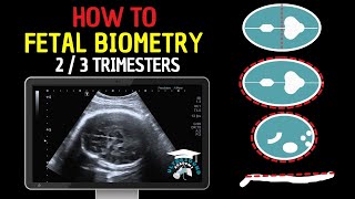 How to Perform Fetal Biometry in the Second and Third Trimesters  Practical Guide [upl. by Ateerys965]