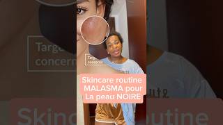 MALASMA Rougeurs et brûlures 🥵 sur le Visage Traitement et soins PeauNoireNurbeauty [upl. by Saddler]