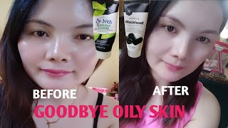 PRODUCT FOR OILY SKIN skincare for oily skin oily skin [upl. by Victor728]