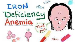 Iron Deficiency Anemia  All you need to know  Causes Symptoms Diagnosis Treatment [upl. by Lasorella]