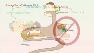 Megaloblastic Anemia Part 1 Vitamin B12 Deficiency Anemia [upl. by Iralam]