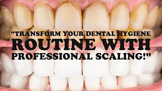 quotTransform Your Dental Hygiene Routine with Professional Scalingquot [upl. by Alhsa]