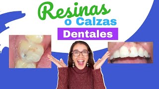 Calzas o resinas dentales ¿cómo las hace mi odontólogo [upl. by Mainis737]