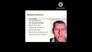 Acromegaly physiotherapy physiology youtube shorts [upl. by Fianna]