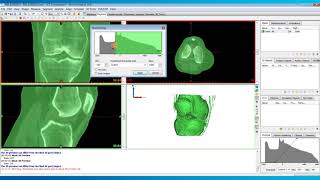 How to Perform Thresholding in Mimics  Mimics Innovation Suite  Materialise Medical [upl. by Rodrich]