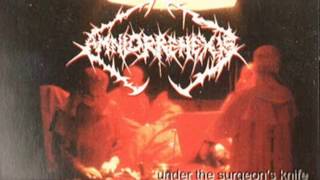 Amniorrehexis  Under the Surgeons Knife 1995 Death Metal Canada Full Demo [upl. by Scales]