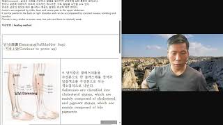 담석증 치유  Cholelithiasis healing [upl. by Auof]