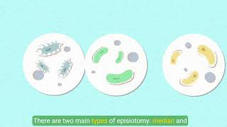 Understanding Episiotomy [upl. by Raffaj]