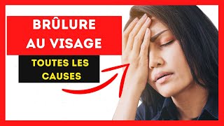 BRÛLURE au VISAGE  Découvrez Toutes Les CAUSES de BRÛLURE Au VISAGE [upl. by Grim3]