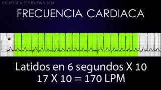 Electrocardiografía Básica Parte 24 [upl. by Acirem498]