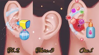 Asmr Ear Wax Removal🔥Asmr Ear wax CleaningAsmr Ear WaxEzafi asmr [upl. by Hadden]