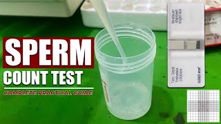 Sperm Count Lab Test  Semen Analysis  Complete video tutorial  Under Microscope [upl. by Eeliak580]