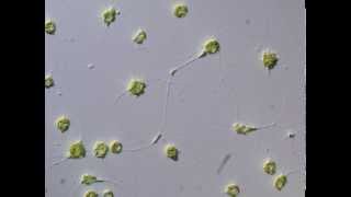 Cytoplasmic movement between cells of Chlorarachniophyte クロララクニオン藻の細胞間における原形質の移動 [upl. by Lomasi]