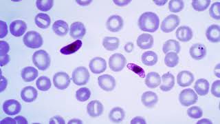 Plasmodium falciparum biology  Wikipedia audio article [upl. by Kirimia]