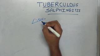 Tuberculous Salphingitis [upl. by Reiss]