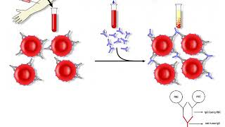 Coombs test direct and indirect [upl. by Ydassac]