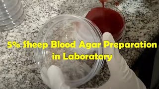 Sheep blood agar preparation in the Laboratory [upl. by Assirralc]