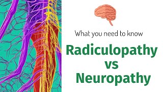 The Difference Between Radiculopathy And Neuropathy  What You Need To Know [upl. by Notfa]