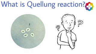 Complete detail ppt on Quellung reaction medicaleducation medicallife [upl. by Geis]