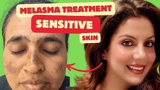 Melasma Treatment for Sensitive skin  Melasma Skincare Routine  Nipun Kapur [upl. by Aimahc]