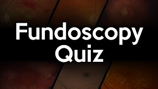 Fundoscopy Quiz [upl. by Allehs881]