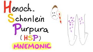 HenochSchönlein Purpura HSP  with a Mnemonic [upl. by Aniger]