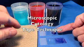 Microscopic Cytology Tape Technique [upl. by Hawkins]