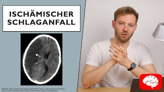 Ischämischer Schlaganfall  Grundlagen der Neurologie [upl. by Theodoric]