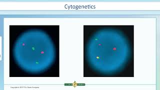 Immunoproliferative and Immunodeficiency Diseases [upl. by Ohara]