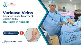 Varicose Veins Advance Laser Treatment Explained by Dr Rajah V Koppala  Avis Hospitals [upl. by Collete]