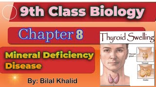 Mineral Deficiency Disease  Goiter amp Anemia  chapter 08  9th class Biology [upl. by Kuhlman]