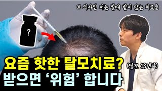 의사인 내가 받지 않는 탈모치료 3가지 feat 효과 부작용 불법시술 [upl. by Georgianne]