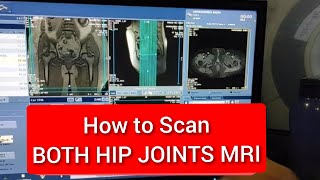 Hip Joints MRI Scan Protocol Positioning amp Planning  Live Demo on GE 15 Tesla [upl. by Rosabel]