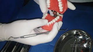 Limpieza de SarroPlaca Dental FACIL [upl. by Annam420]