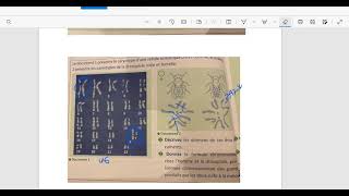 Exercice4 Caryotype et Formule Chromosomique [upl. by Fisken]