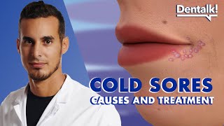 Do you have COLD SORES TREATMENT and CAUSES of the herpes virus on LIPS  Dentalk © [upl. by Hazelton]