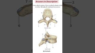 identify the parts of vertebrae humananatomy [upl. by O'Hara]