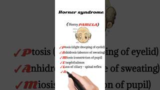 horner syndrome mnemonic [upl. by Raymond]